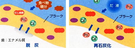 食後すぐの歯みがき