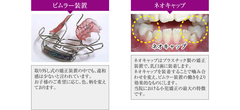 歯周病の発生するリスク